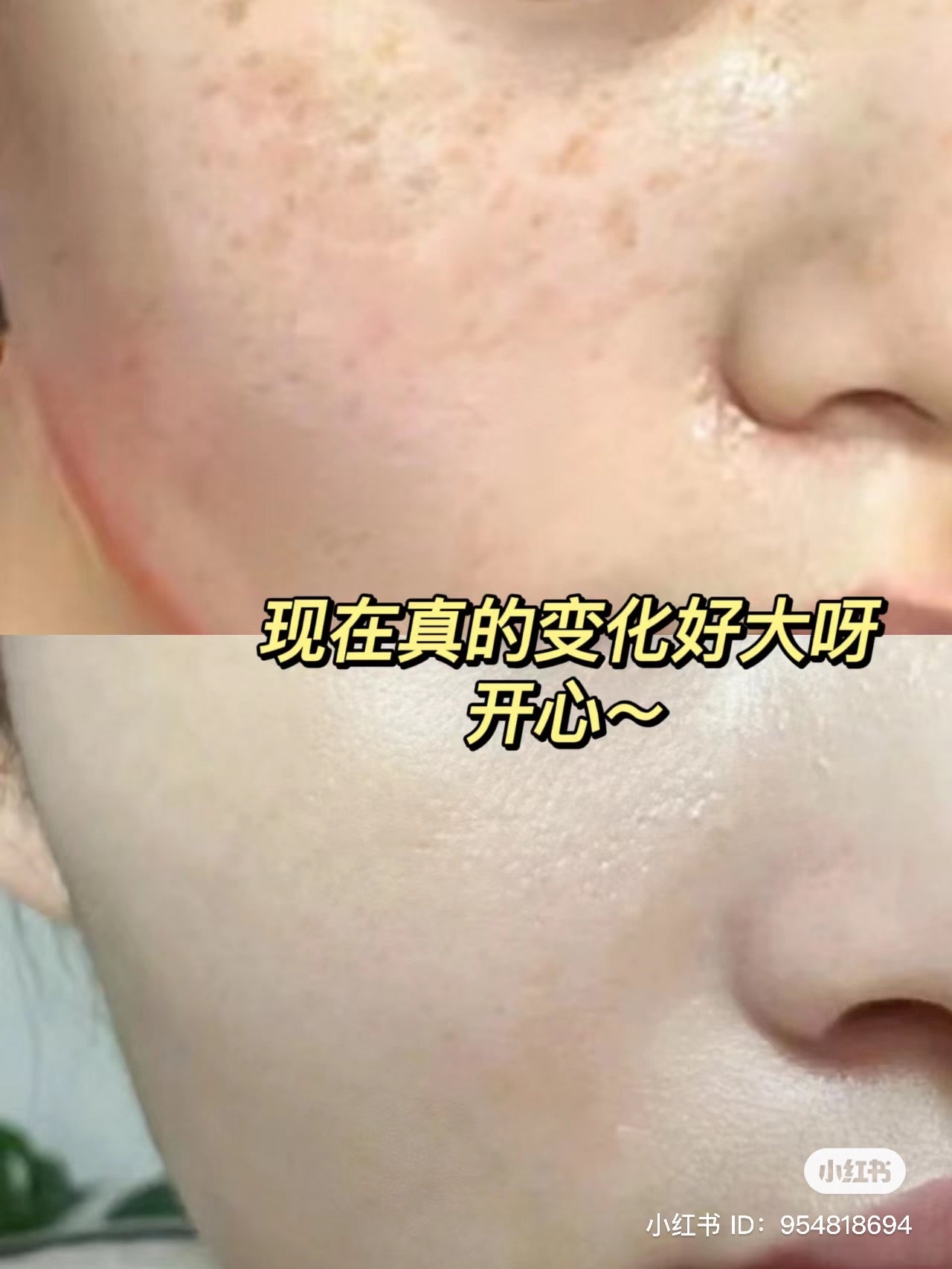 Nature Republic|舒缓镇静晒后修复补水芦荟胶/天然护肤/消闭口/缩毛孔|300ml