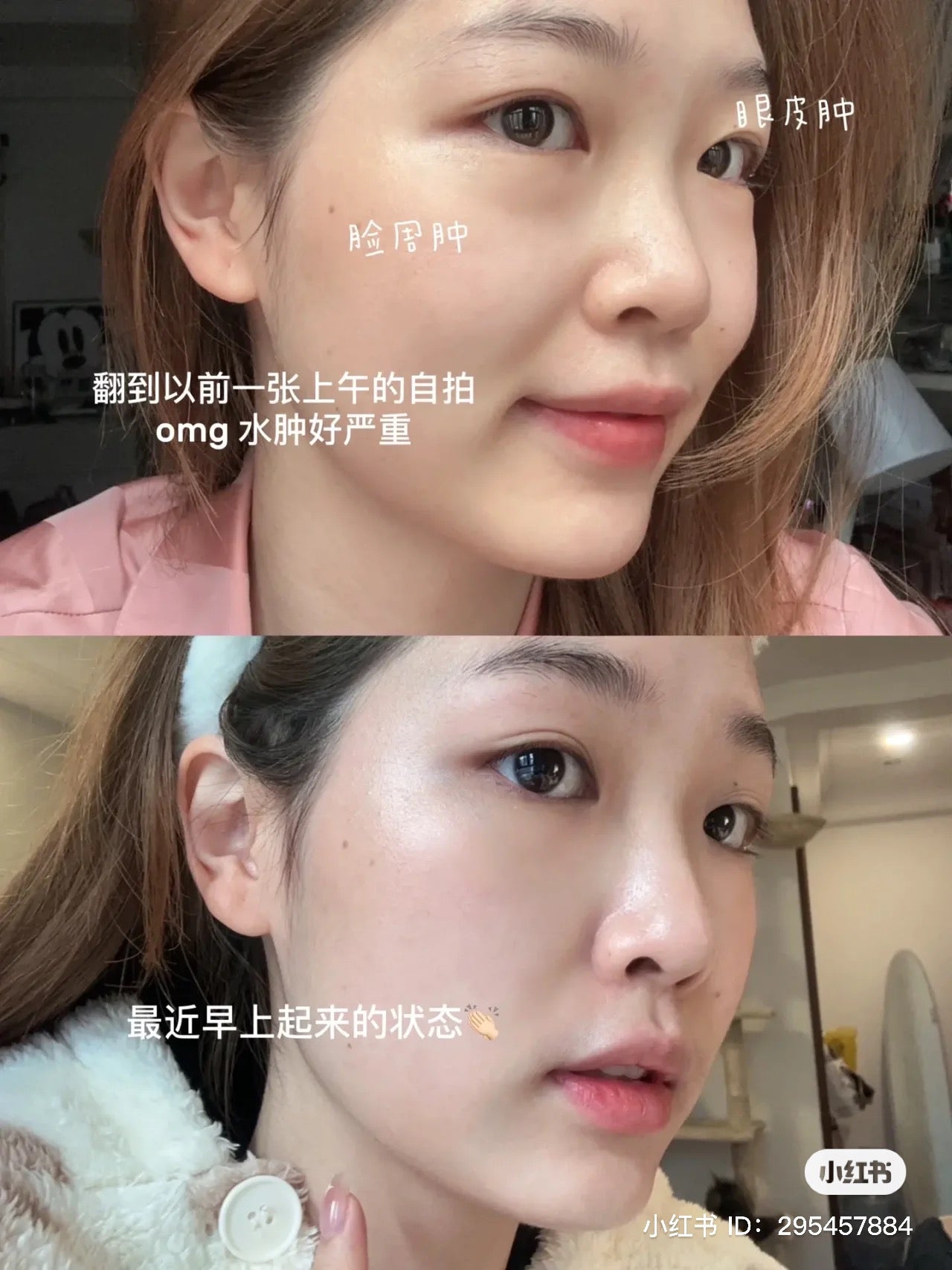 SVELTY丝蓓缇|消水丸/柠檬橙皮苷颗粒利尿排水/植物酵素小丸子|14回分【28.02】