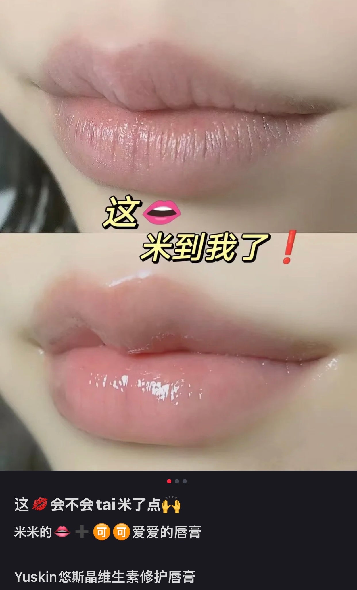 Yuskin悠斯晶|唇炎救星/补水防干裂润唇膏/孕妇儿童可用/唇纹变淡/唇部变软|3.5g