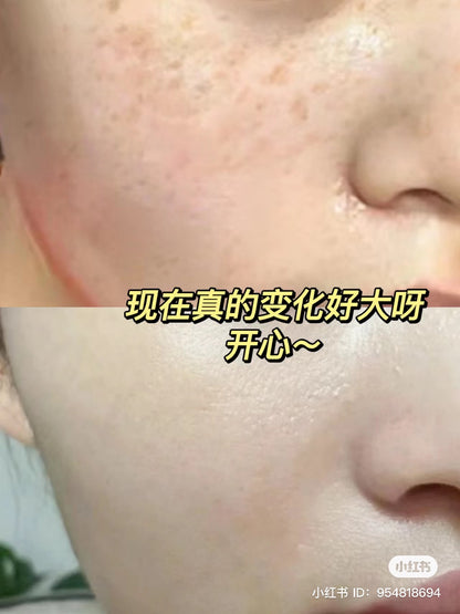 Nature Republic｜舒缓镇静晒后修复补水芦荟胶/天然护肤/消闭口/缩毛孔｜300ml