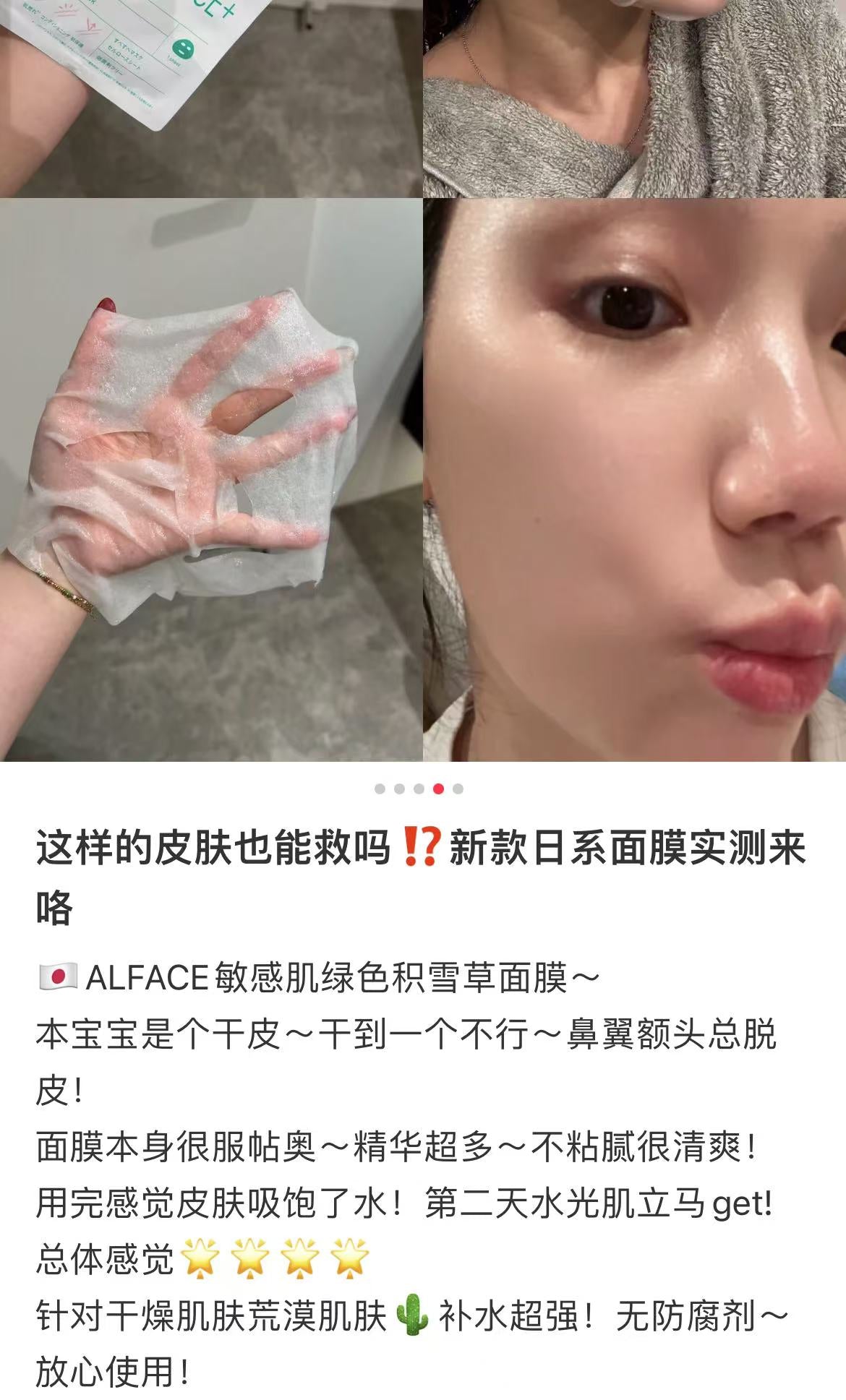 ALFACE｜Moist Mask｜ 25ml x 4 pieces
